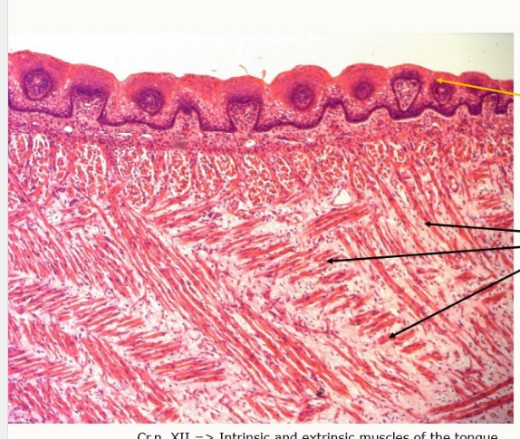 <p>What histological features canw e identify on the tongue muscle?</p>
