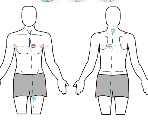 <p>What are the locating electrodes?</p>