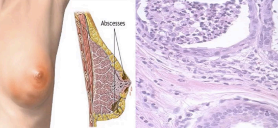<p>What pathology?</p>