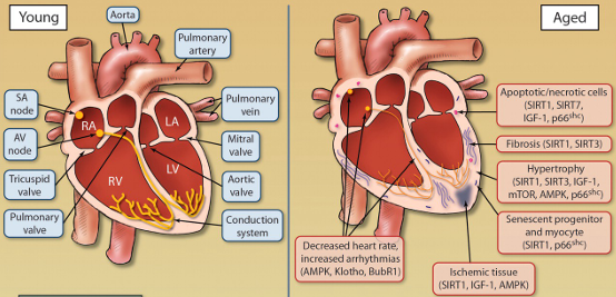 <p>Greater stiffness/rigidity of heart muscle<br>Increase in thickness of heart walls<br>Decreased HR and possible arrhythmias<br>Heart fills with blood more slowly</p>