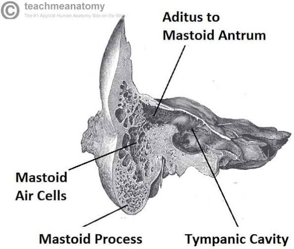 <p>via the epitympanic recess and mastoid antrum</p>
