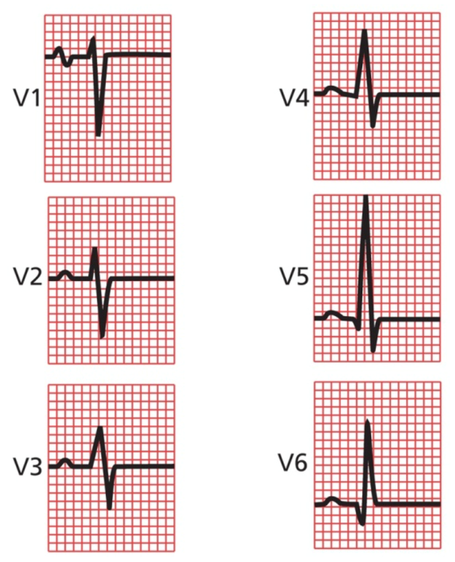 <p>V5 and V6</p>