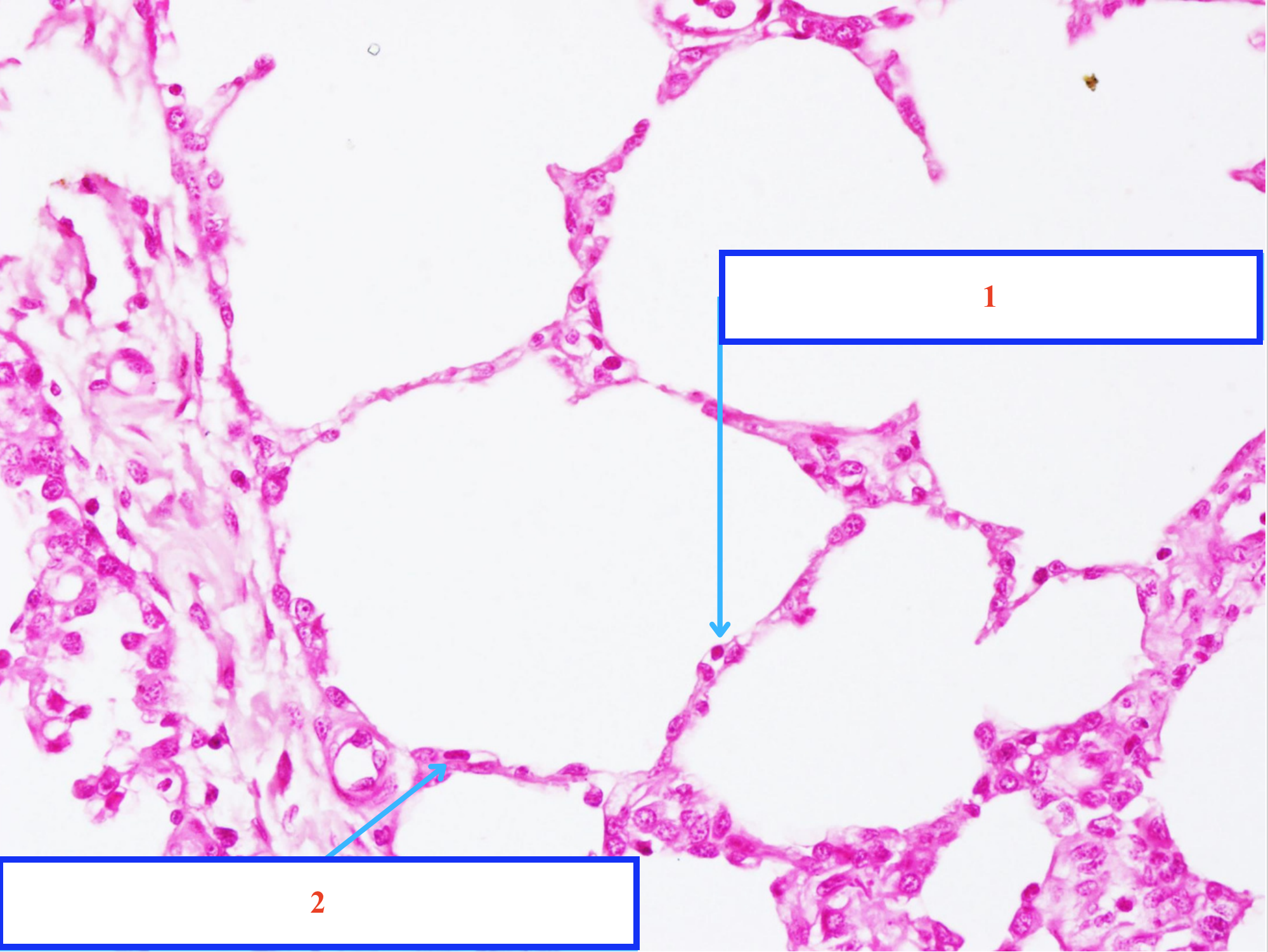 <p>Tế bào gì ?</p>