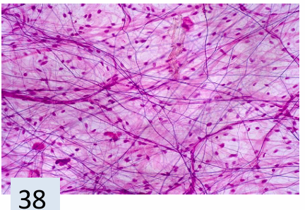 <p>what tissue is this? </p>
