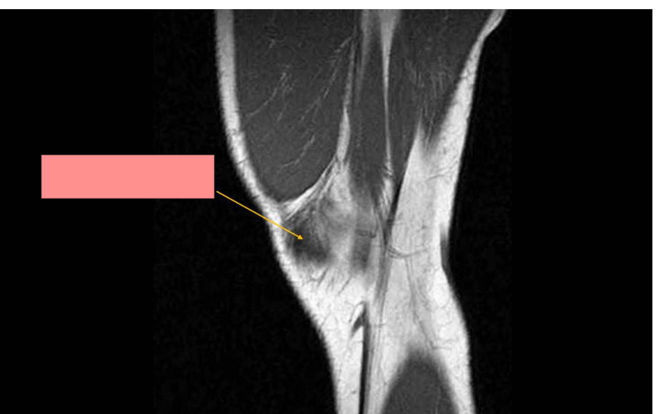 <p>Identify the structure</p>