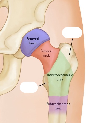 <p>Identify this bone features covered by the white marks and define their anatomical purpose. </p>
