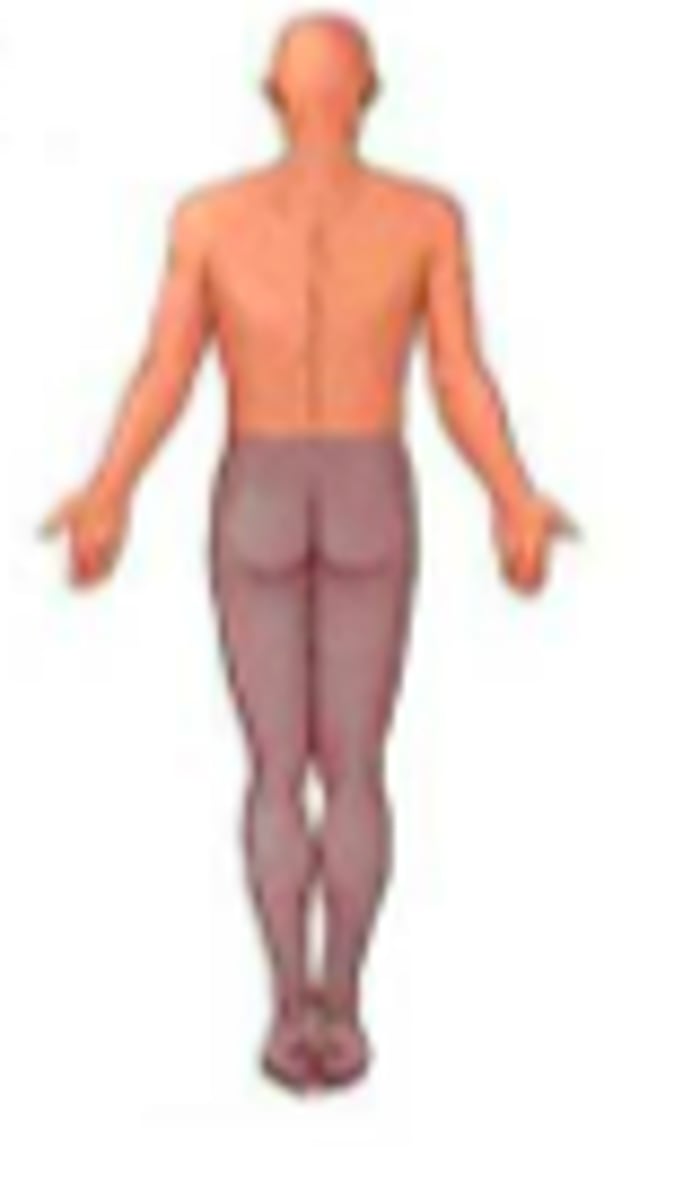 <p>Loss of function in lower extremities.</p>