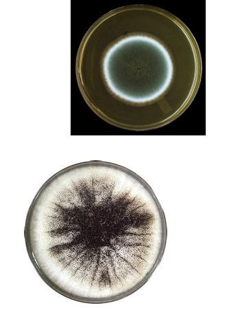 <p>fungal; yeats; cutaneous<br><br>acidic; color</p>