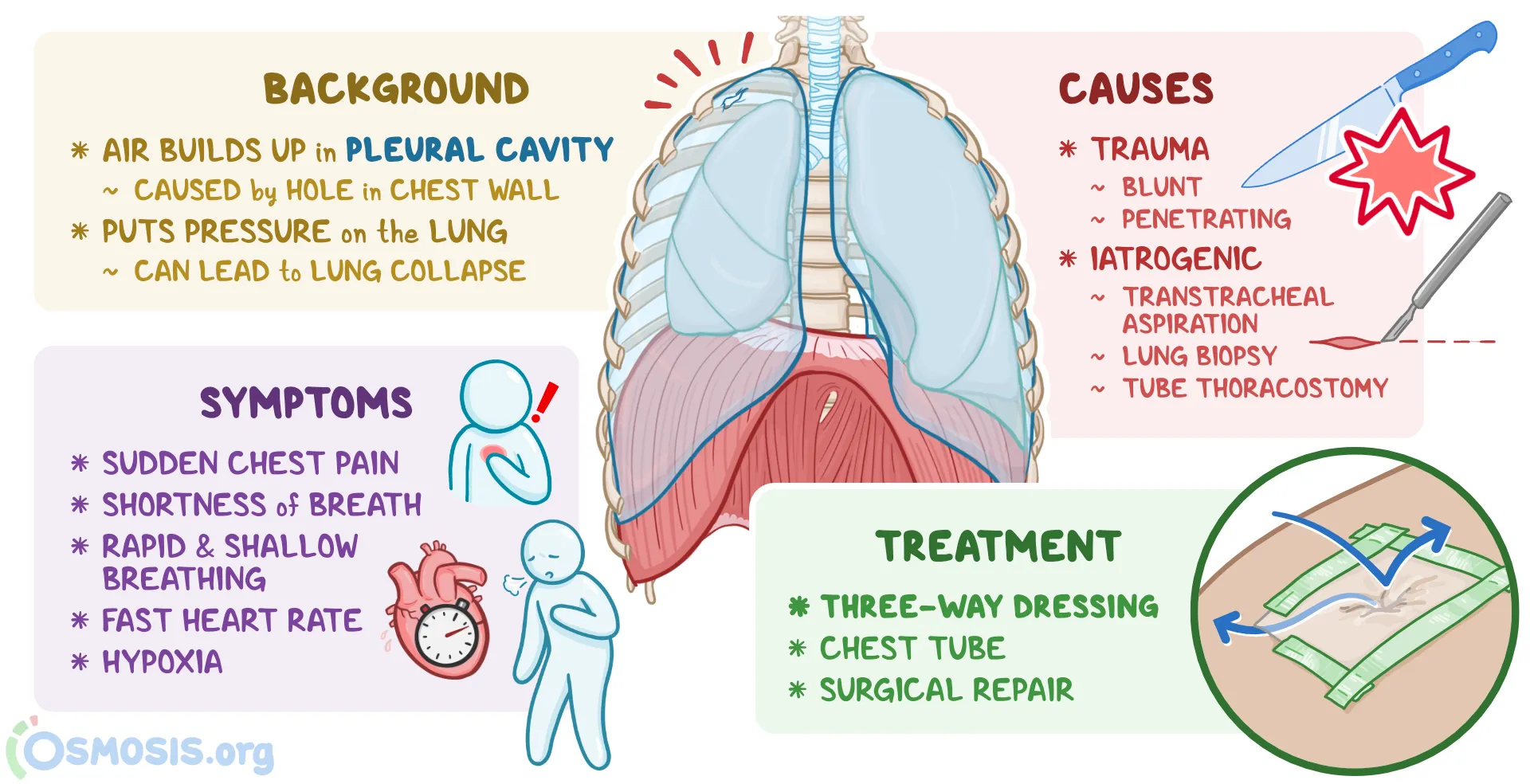 <p><span style="color: yellow;"><strong>Open Pneumothorax</strong></span></p><p><span><strong>-</strong></span><span style="font-family: "Times New Roman", serif;">Chest-wall defect communicating with pleural space</span></p><p><span style="font-family: "Times New Roman", serif;">tx: </span><span>Vented occlusive dressing + chest tube away from wound → definitive wound closure</span></p>