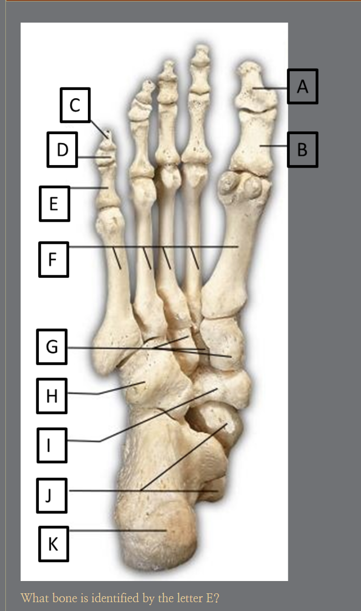 <p>E?</p>
