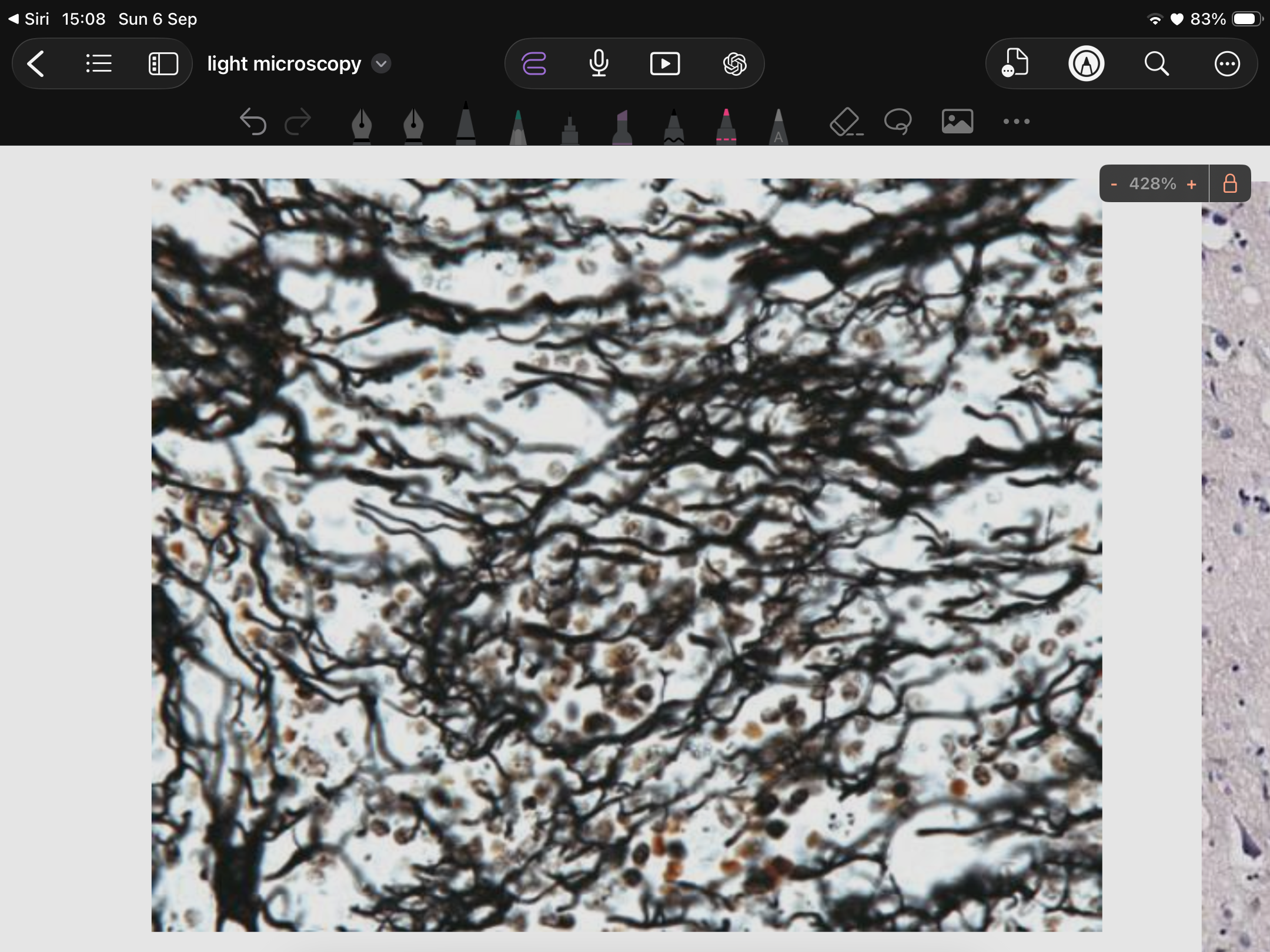 <p>what does this show (staining)</p>