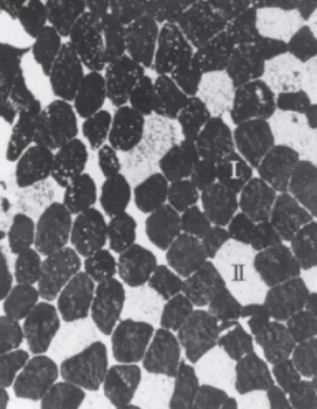 <p>what types of sport does this person likely play</p>