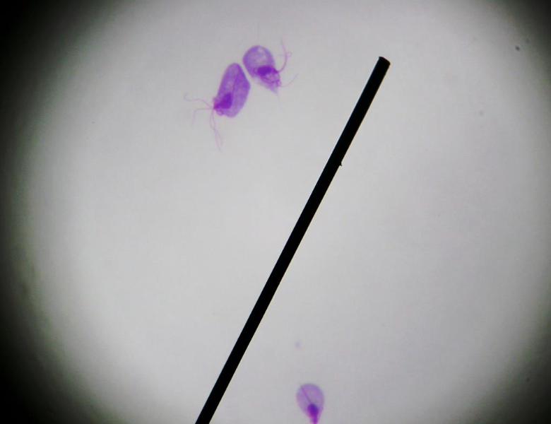 <p>What kingdom does <u>Trichomonas vaginalis</u> belong to?</p>