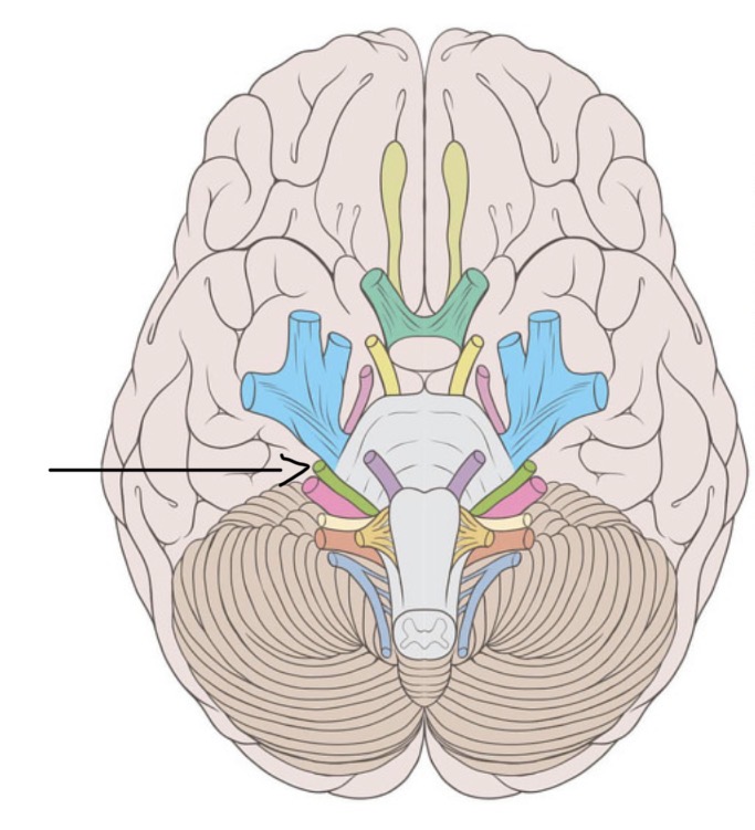 <p> seventh cranial nerve, managing facial movements, taste, and gland secretions</p>