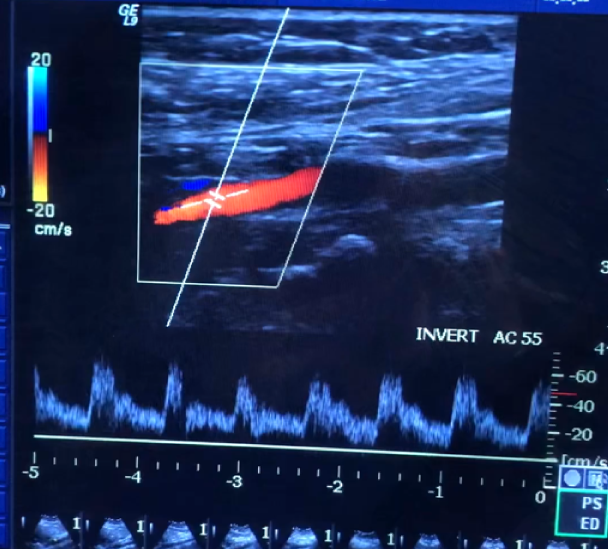 <p>Identify the vessel</p>