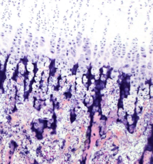<p>zone of reserve cartilage, zone of proliferation, zone of hypertrophy, zone of calcified cartilage, and zone of resorption</p>