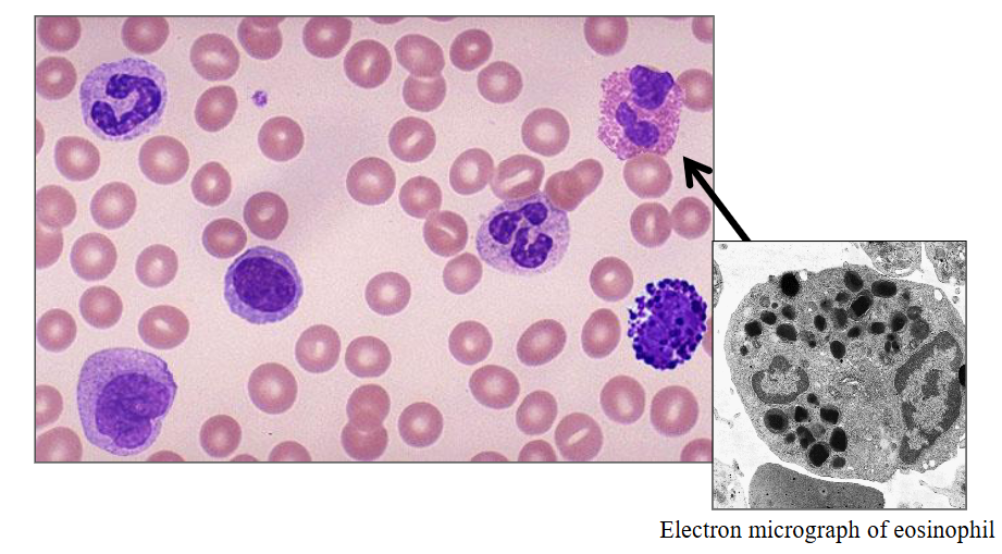 <p>b) Eosinophils</p>