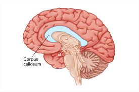<p>Corpus Callosum </p>