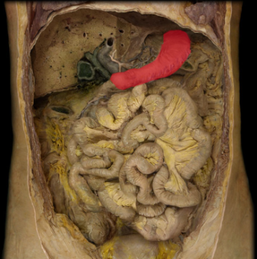 term image