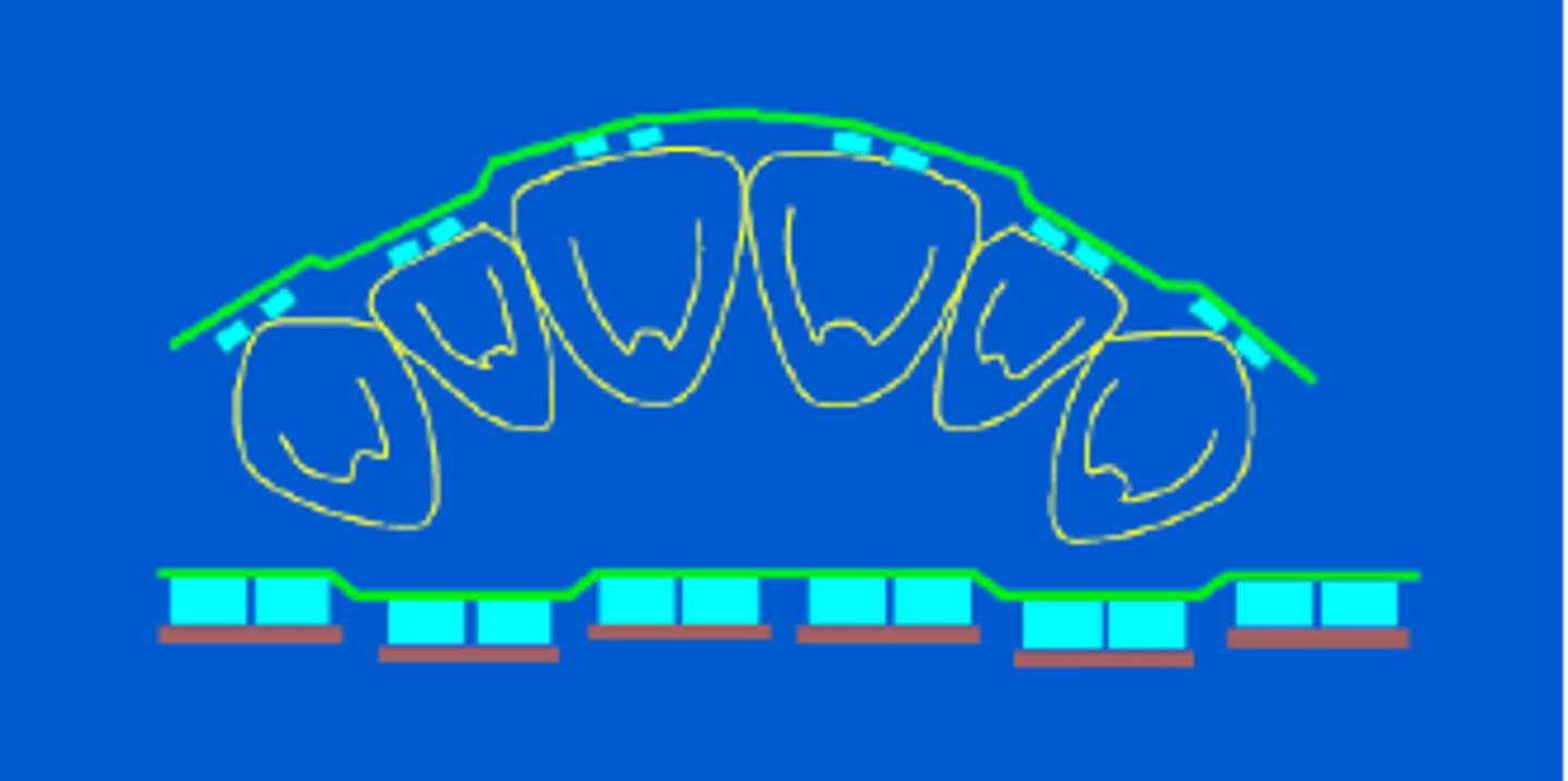 <p>ID the bend order:</p>