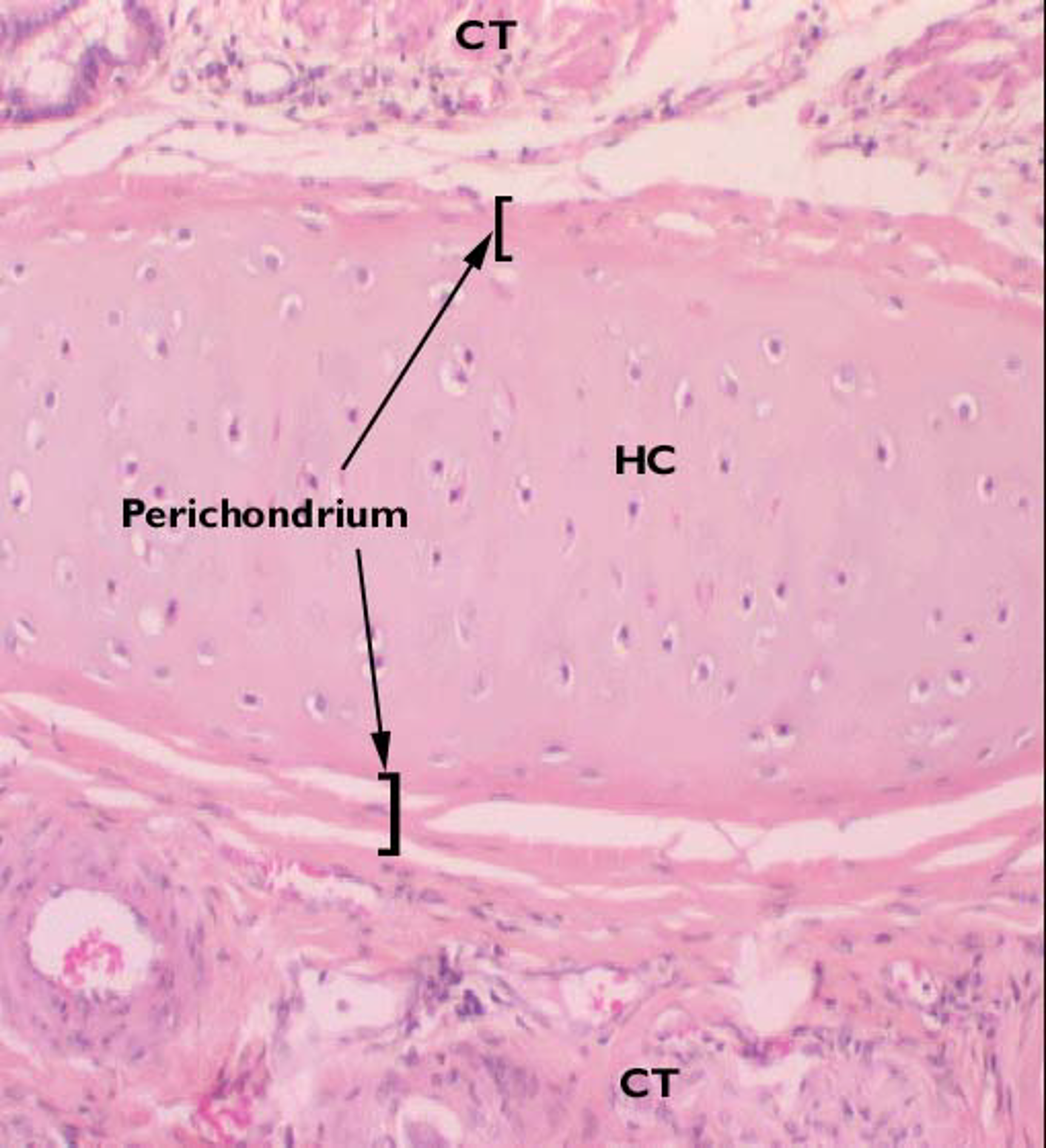 <p>Perichondrium</p>