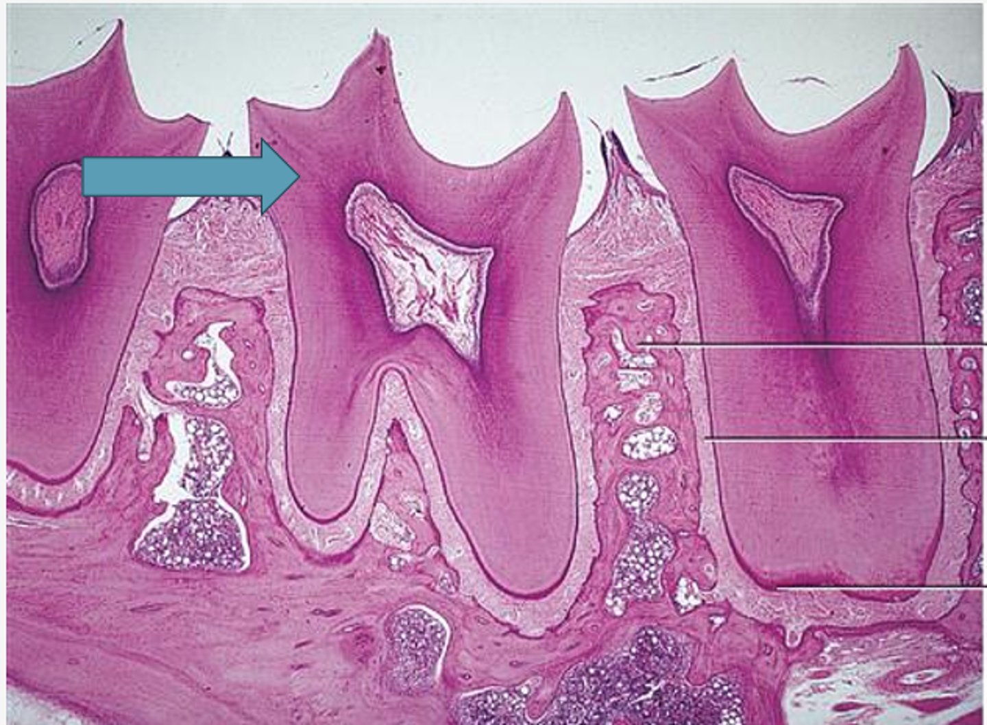 <p>Identify the region of the tooth</p>