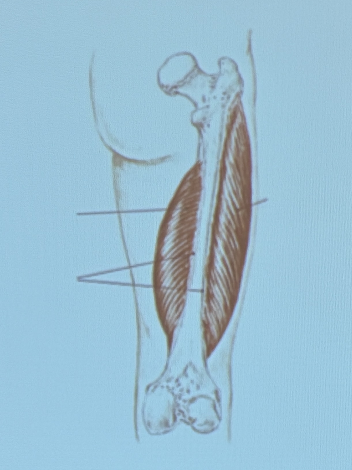 <p>Muscle name?</p>