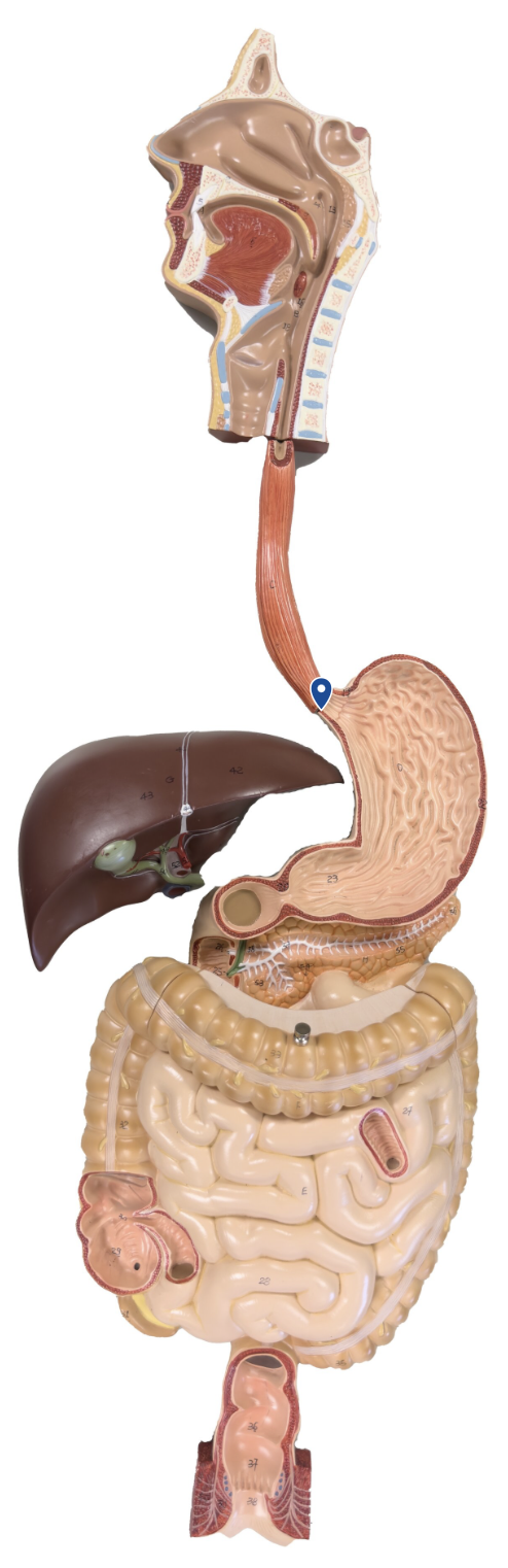 <p>Name this opening.</p>