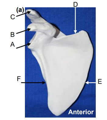 <p>What bone is this? What view of the bone is this?</p>