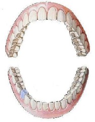 <p>mandibular right second bicuspid</p>