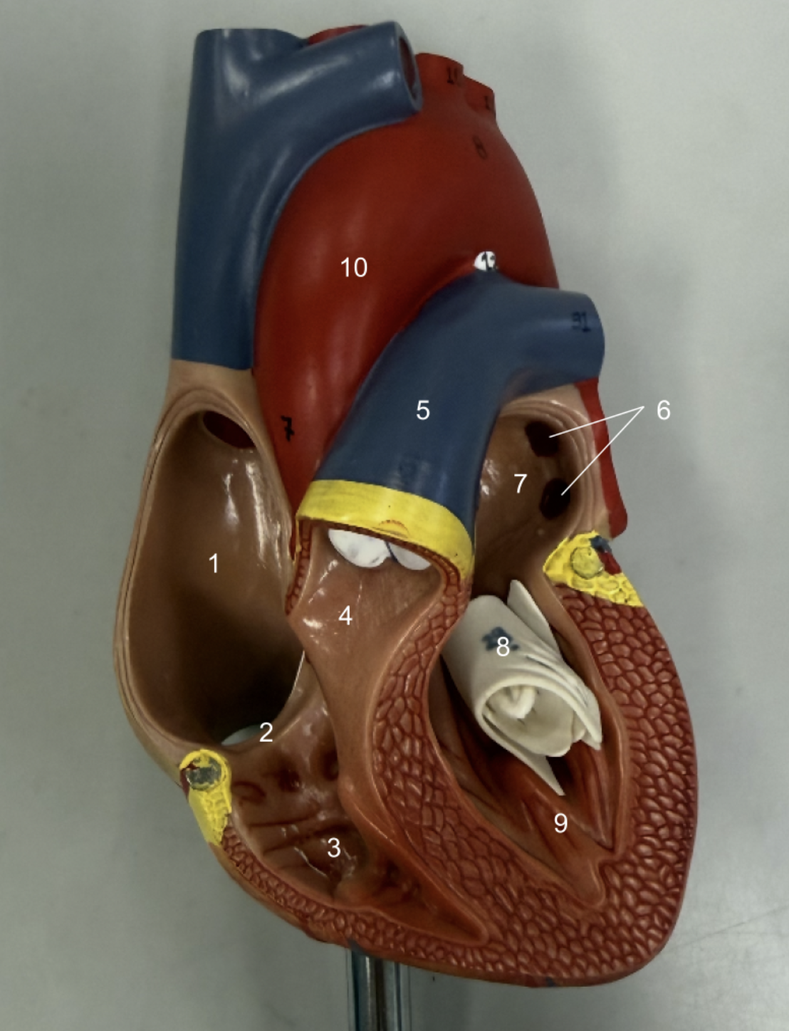 <p><span style="background-color: transparent;">What is structure 5?</span></p>