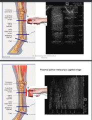 <p>rotate probe 90°, from transverse to sagittal image</p>