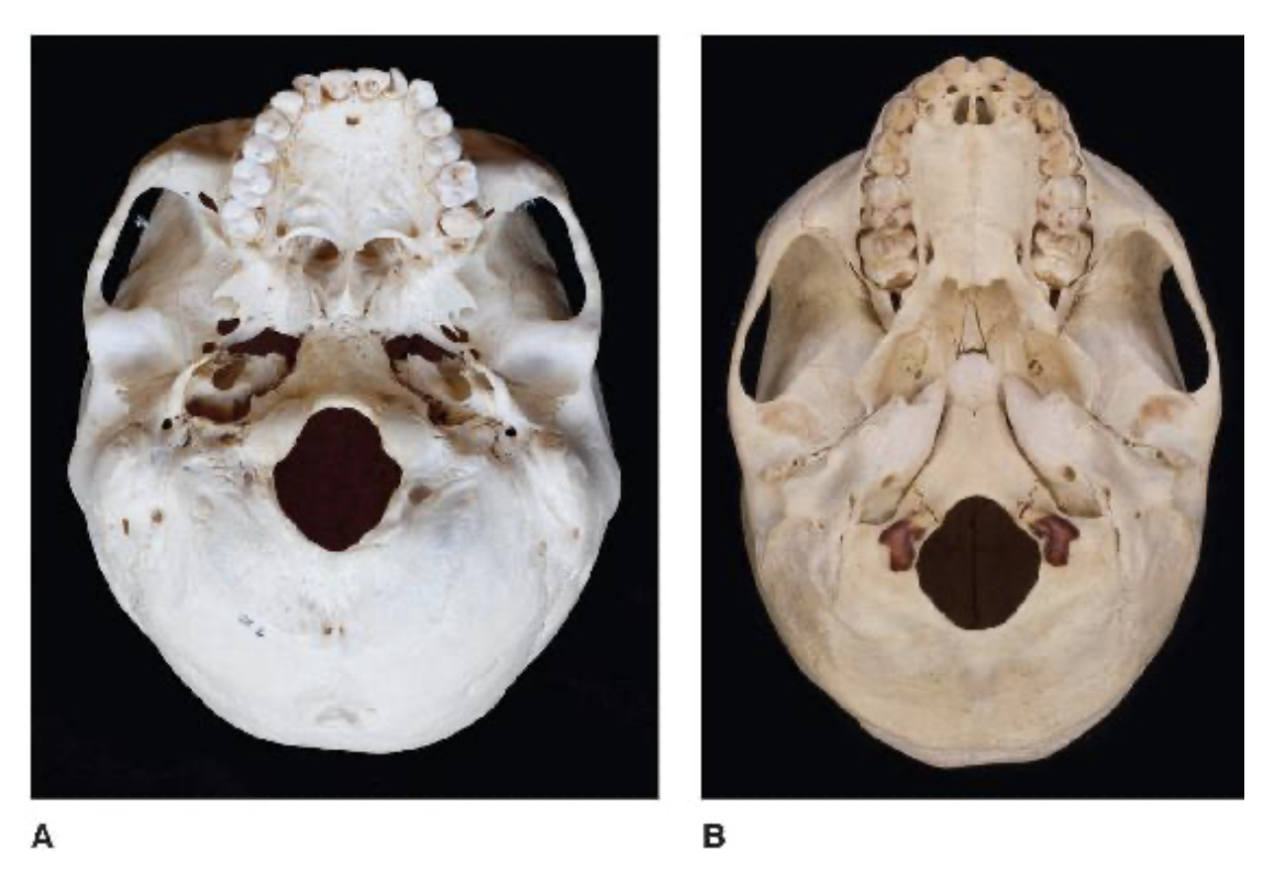 <p>Pre-Australopiths </p>