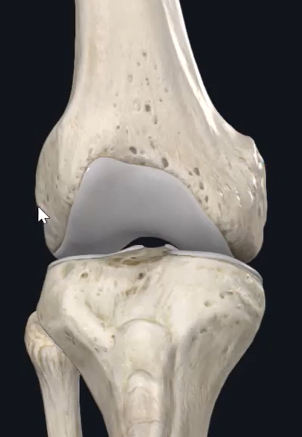<p>what is this small protruding piece of bone on top of the lateral condyle refered to as?</p>