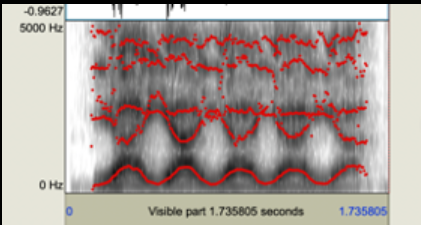 <p>This spectrogram is most likely </p>