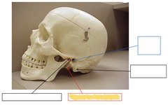 <p>landmarks of the Temporal Bone</p>