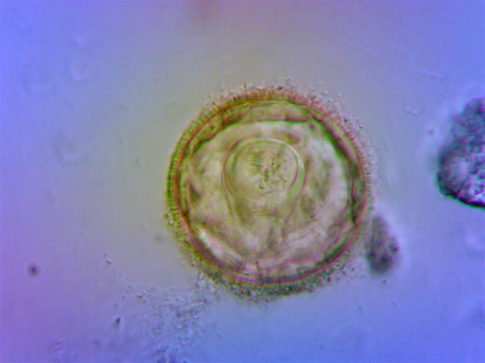 <ul><li><p>Tapeworms</p></li><li><p>Most concerning tapeworm is found in canids because they can form cysts in non-definitive hosts </p></li><li><p>Eggs can be infective once shedded</p></li></ul><p></p>