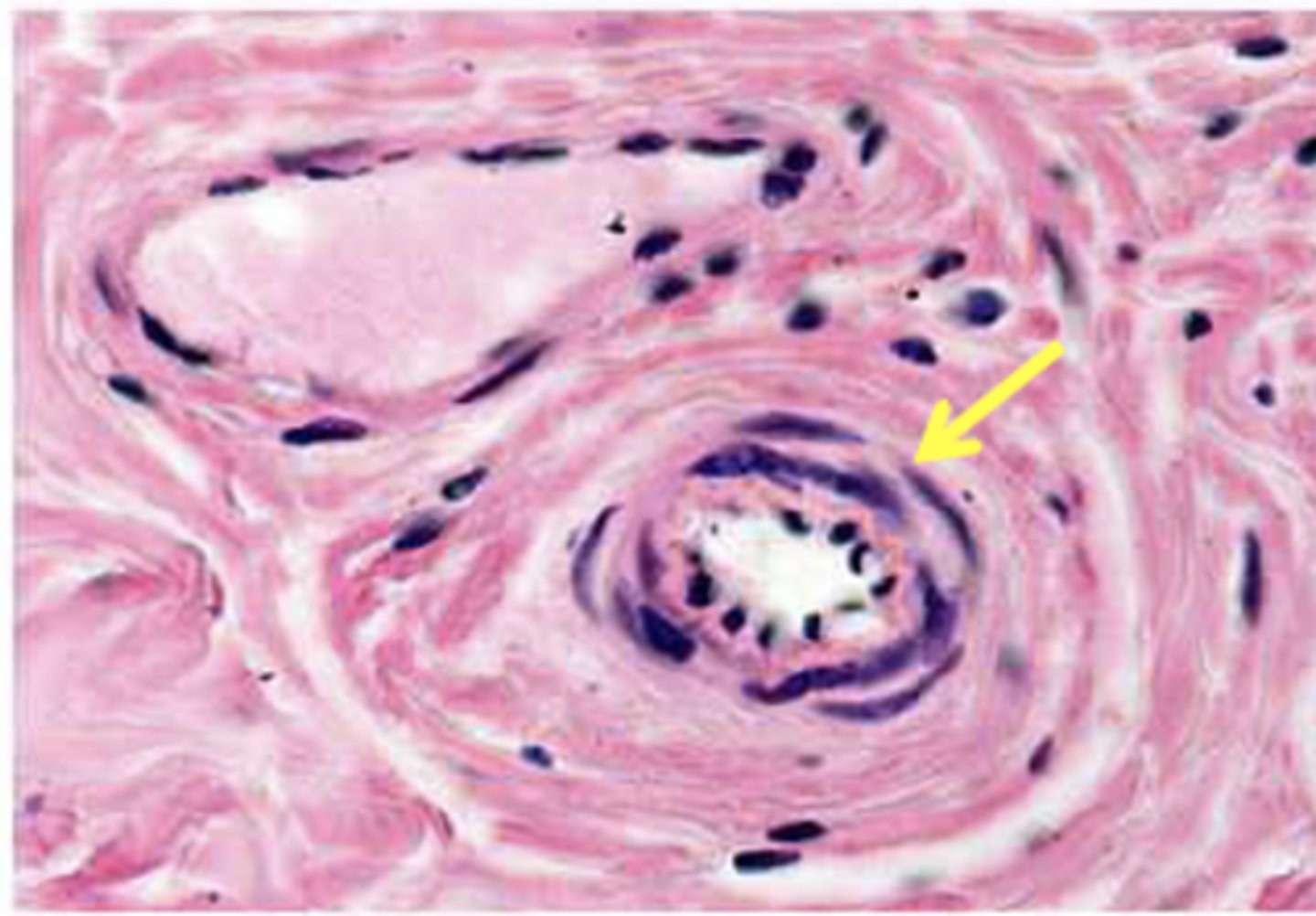 <p>Classify the vessel</p>
