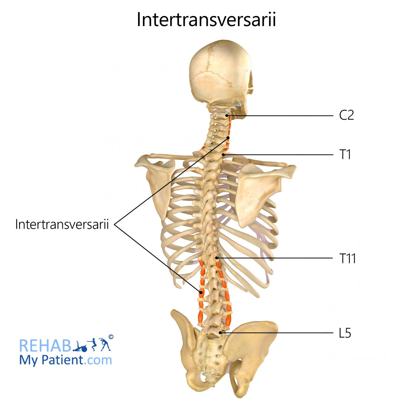 <ul><li><p>short muscles that connect adjacent transverse processes of vertebrae</p></li><li><p>small muscular slips are present in the thoracic region, but they are mostly present in the cervical and lumbar region</p></li><li><p>the lumbar intertransversarii consist of 4 pairs of muscles on either side of the vertebral column, and each pair has a medial and lateral component  (intertransversarii laterales lumborum and mediales lumborum)</p></li><li><p>in the cervical region, they are divided into anterior and posterior parts</p></li></ul><p></p><p>origin → colli: transverse processes of cervical vertebrae</p><p>          → lateral lumbar: transverse and accessory processes of vertebrae L1-L4</p><p>          → medial lumbar: accessory processes of vertebrae L1-L4</p><p>insertion → colli: transverse processes of adjacent vertebrae</p><p>               → lateral lumbar: transverse processes of succeeding vertebrae</p><p>               → medial lumbar: mammillary processes of succeeding vertebrae</p><p>action → colli: assists in lateral flexion of the cervical spine, stabilizes cervical spine</p><p>           → lumborum: assists in lateral flexion of lumbar spine, stabilizes lumbar spine</p><p>innervation → anterior rami of spinal nerves</p><p>blood supply → colli: occipital, deep cervical, vertebral arteries</p><p>                     → lumbar: dorsal branches of lumbar arteries</p>