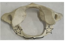 <p>what is marked? (not the star)</p>
