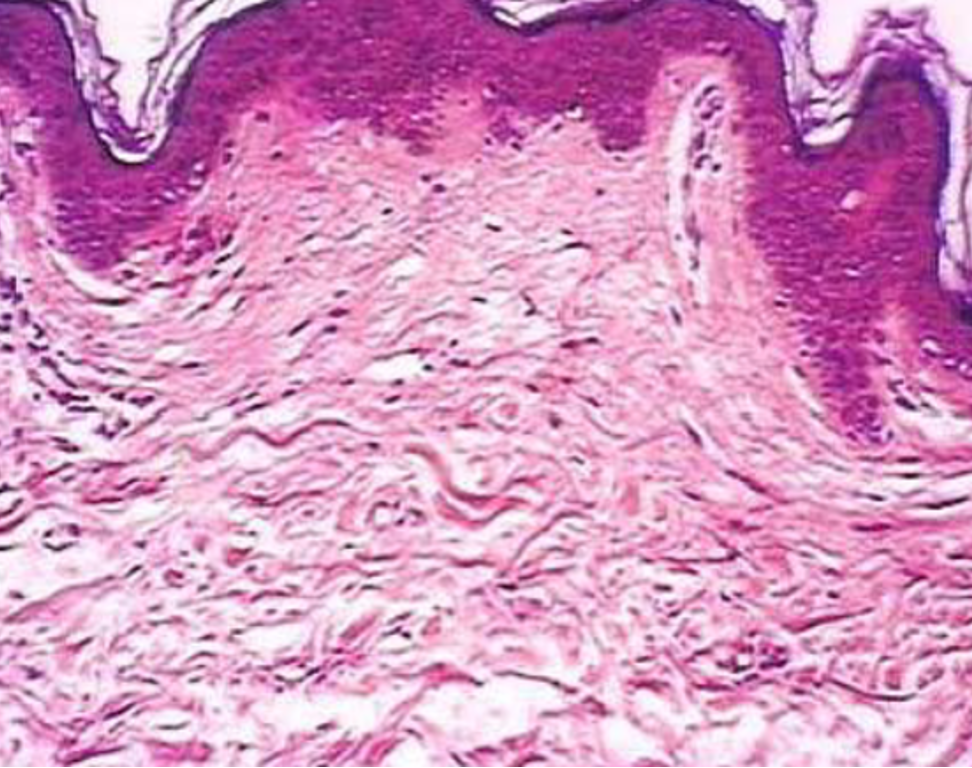 <p>skin- what is the dermis </p>