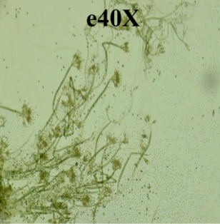 <p>Giống penicillium như là hoa khô</p><p>Màu vàng nâu</p>