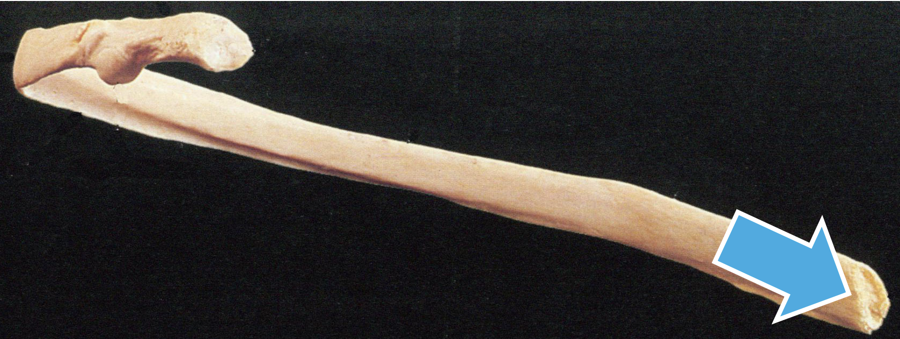 <p>General feature of the ribs</p>