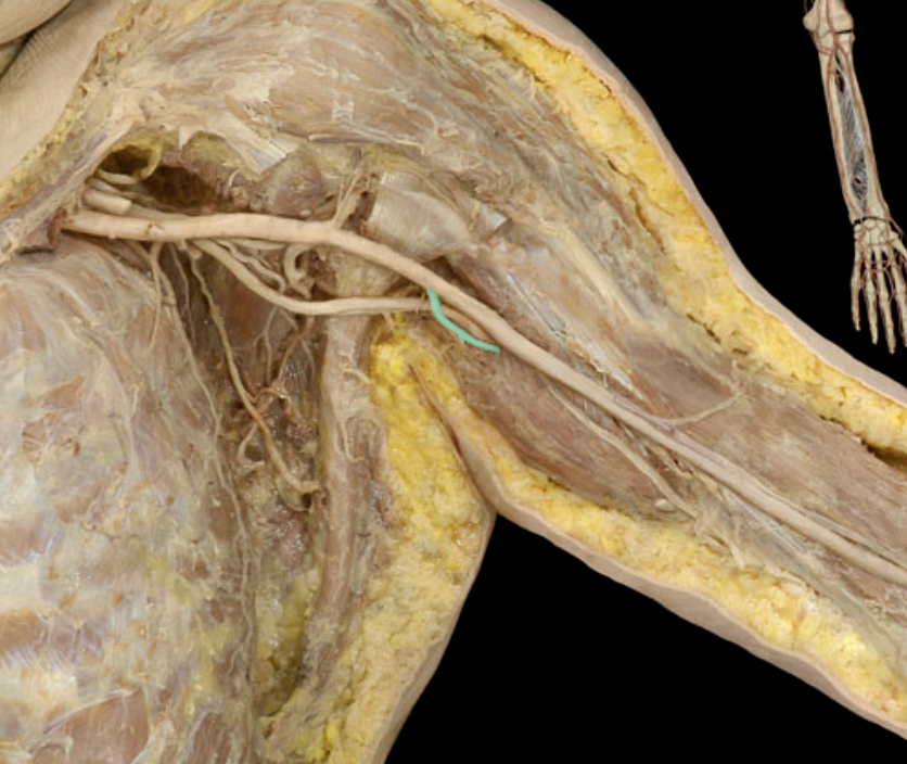 <p>Identify the blood vessel of the upper extremity</p>