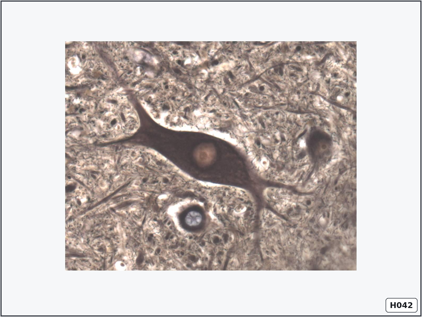 term image