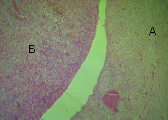 <p>B</p>