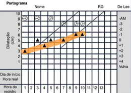 <p>Qual o padrão do partograma? O que pode ser feito?</p>