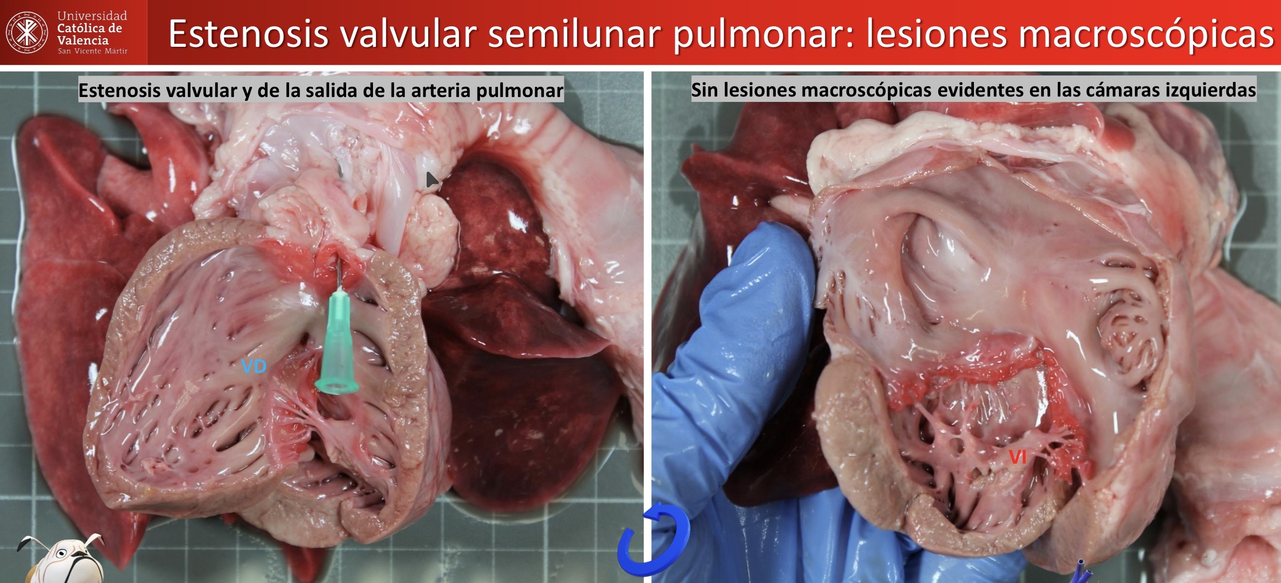 <p>Patogenia </p>