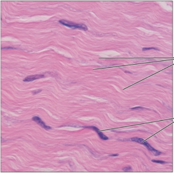 <p><span><strong>Connective tissue proper; dense regular connective tissue</strong></span></p>