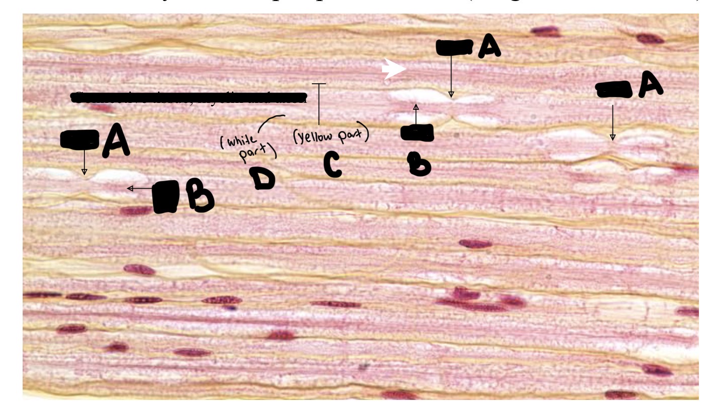 <p>Label This Myelinated Peripheral Nerve (longitudinal): function?</p>